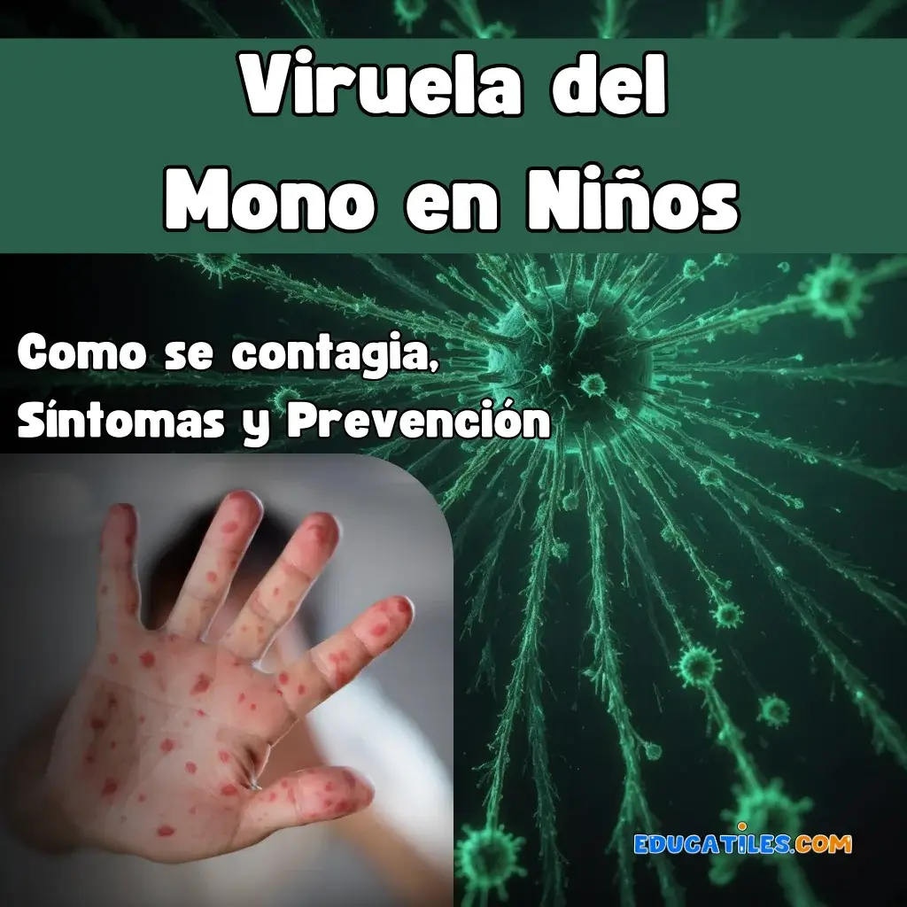 Viruela del mono como se contagia​